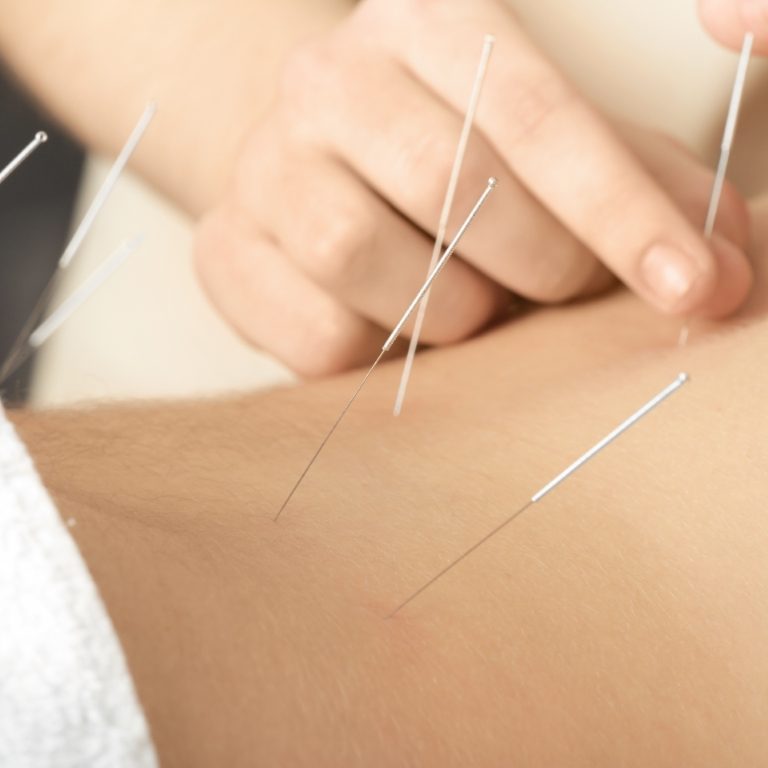 acupuncture treatment near franklin, acupuncture clinic near franklin, acupuncture near franklin