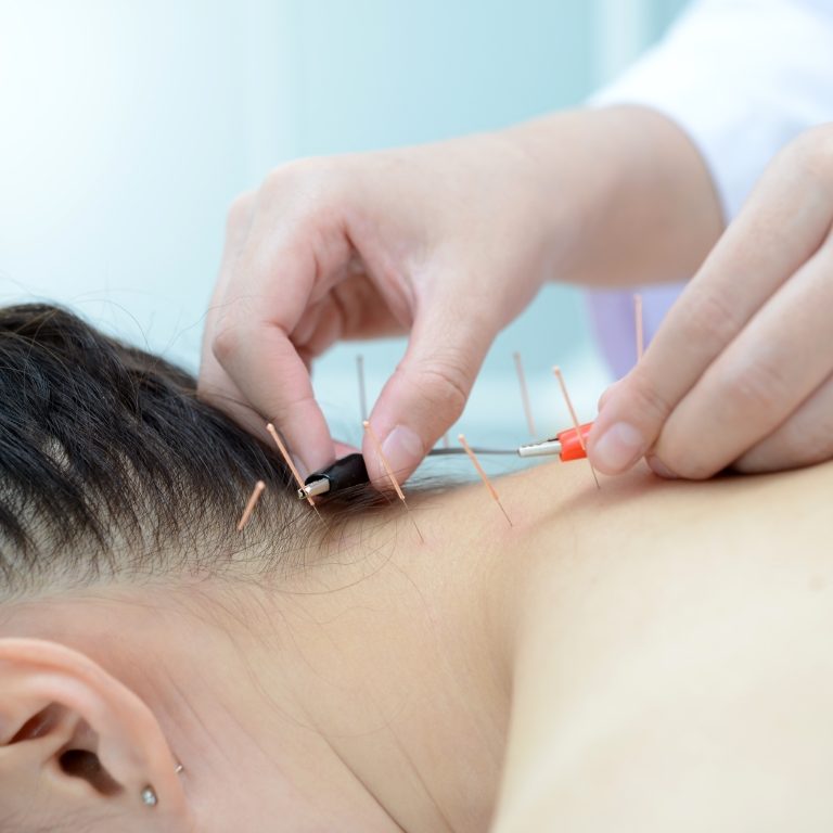 best acupuncture clinic near Franklin, Franklin acupuncture clinic, the best acupuncture clinic in Franklin