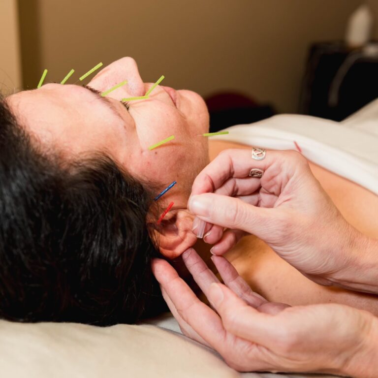 acupuncture services near Franklin, leading acupuncture services near Franklin, Franklin's favorite acupuncture services