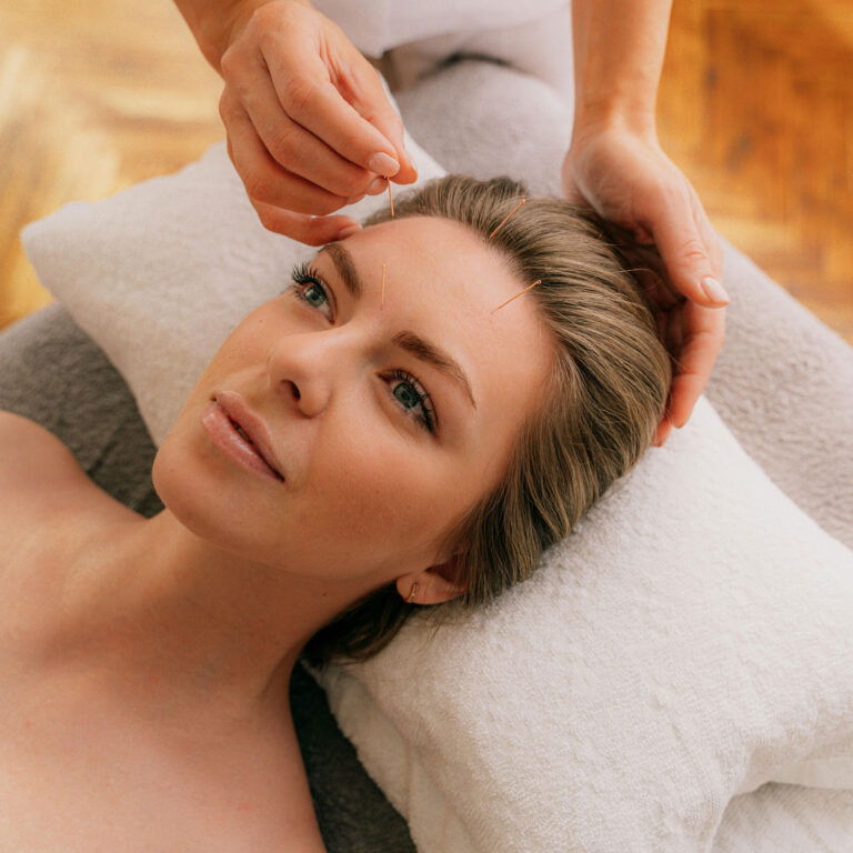 cosmetic-acupuncture-2