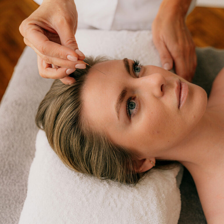 cosmetic-acupuncture-3